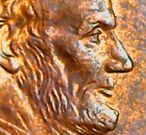 2000-Cent-Doubled-Lower-Eye-Lid-Isn't-Normal